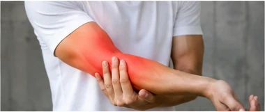 Tennis Elbow & Golfer’s Elbow physiotherapy condition visual