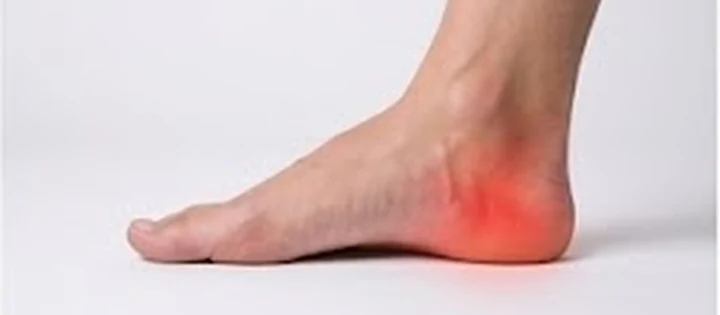 Ankle Injuries physiotherapy condition visual