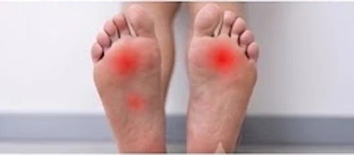Running Injuries physiotherapy condition visual